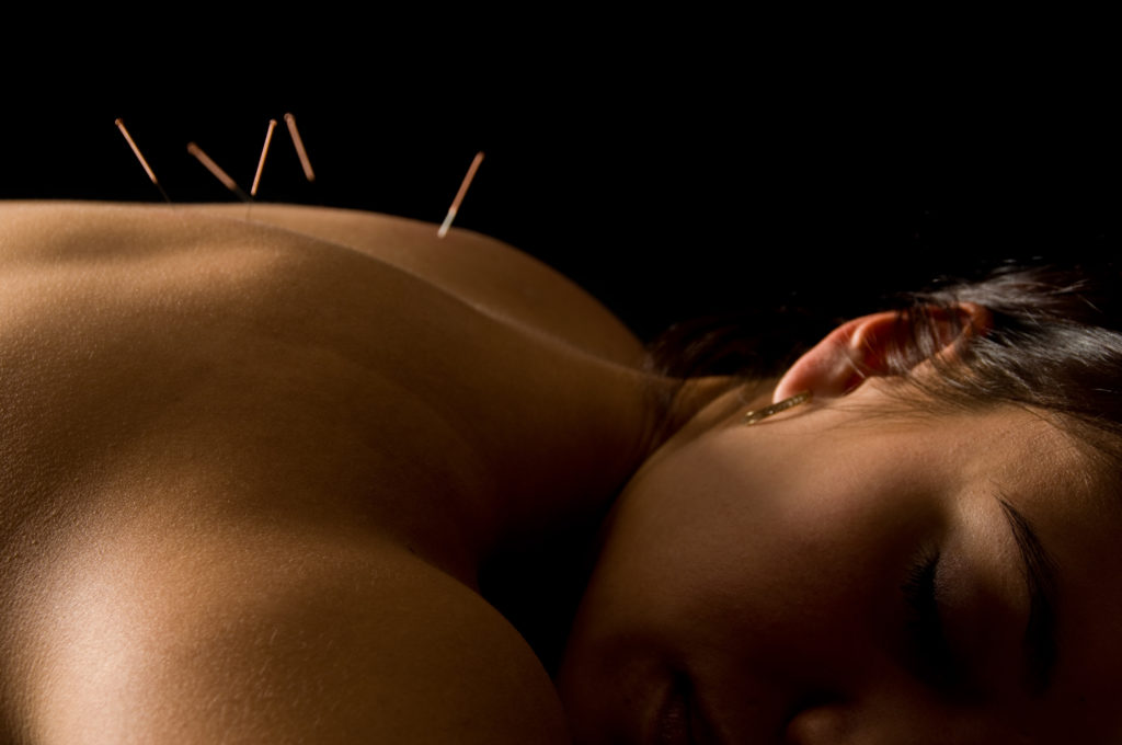 acupuncture can shorten how long your cold lasts.