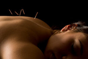 acupuncture can shorten how long your cold lasts.